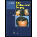 Hair Replacement Surgery