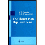 Thrust Plate Hip Prosthesis