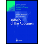 Spiral Ct of the Abdomen