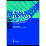 Bone Disease