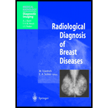 Radiological Diagnosis of Breast Diseases