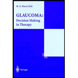 Glaucoma  Decision Making in Therapy