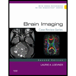 Brain Imaging Case Review