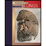 Pathology of Lung Tumors