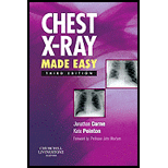 Chest X Ray Made Easy