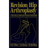 Revision Hip Arthroplasty