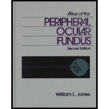 Atlas of Peripheral Ocular Fundus