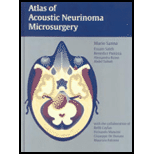 Atlas of Acoustic Neurinoma Microsurg.