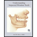 Understanding Impacted Wisdom Teeth