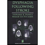 Dysphagia Following Stroke