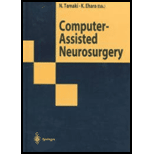 Computer Assisted Neurosurgery