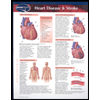 Heart Disease and Stroke Chart Size: 2 Panel by Permacharts - ISBN 9781550807196